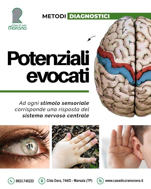 I #Potenziali #Evocati sono tra le metodiche diagnostiche impiegate presso Casa di Cura Morana.