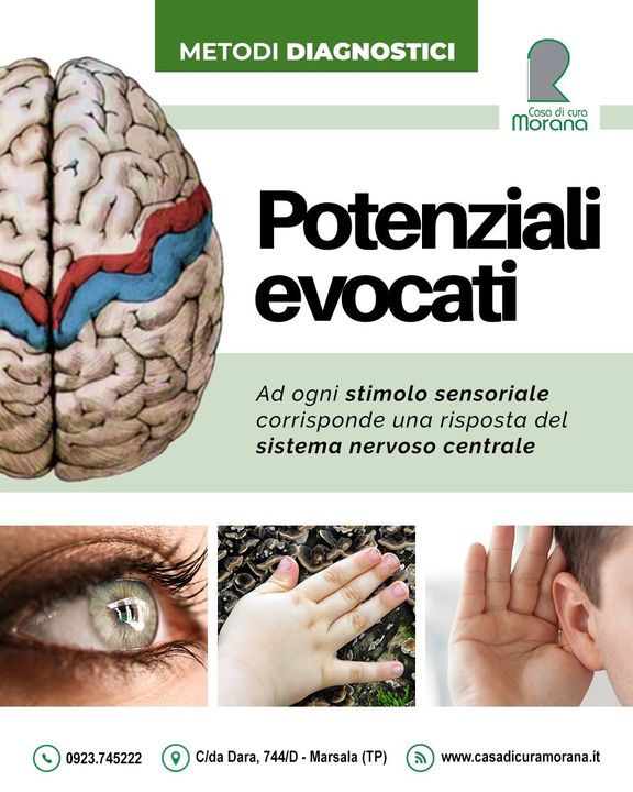 I #Potenziali #Evocati sono tra le metodiche diagnostiche impiegate presso Casa di Cura Morana.