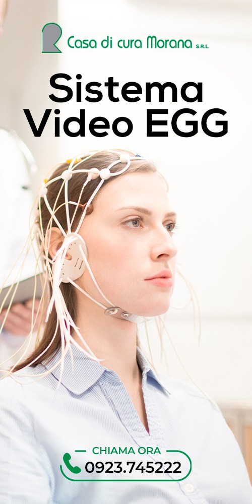 Sai cos'è la Video-EGG?🧠

Acronimo di 
